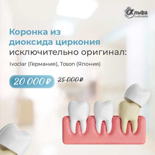 КОРОНКА ИЗ ДИОКСИДА ЦИРКОНИЯ СО СКИДКОЙ 5000