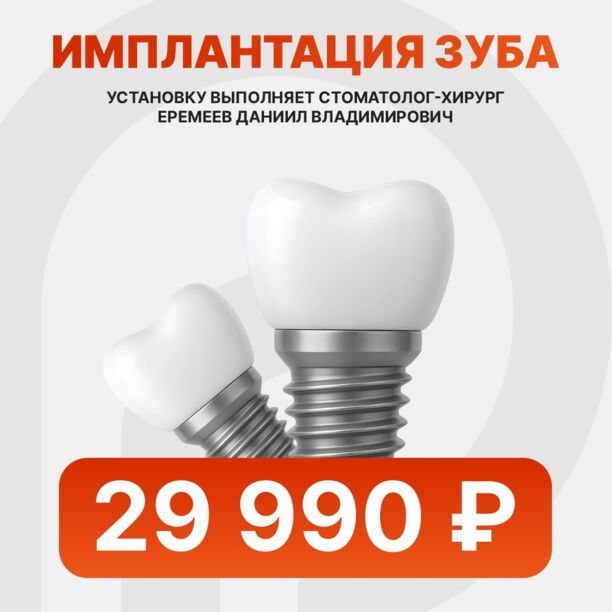 Имплантация зубов 29990