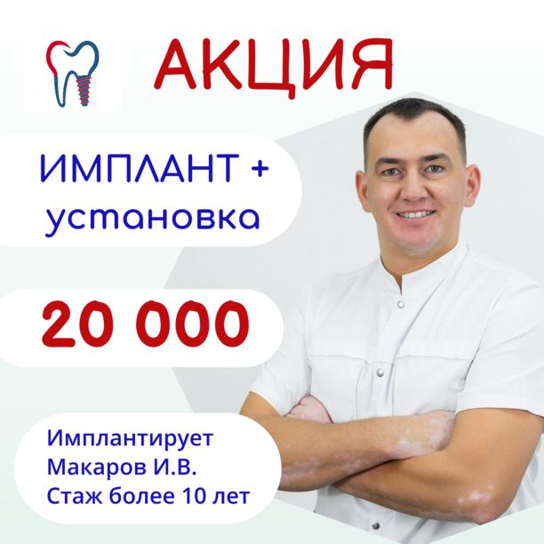 Имплант Osstem +установка