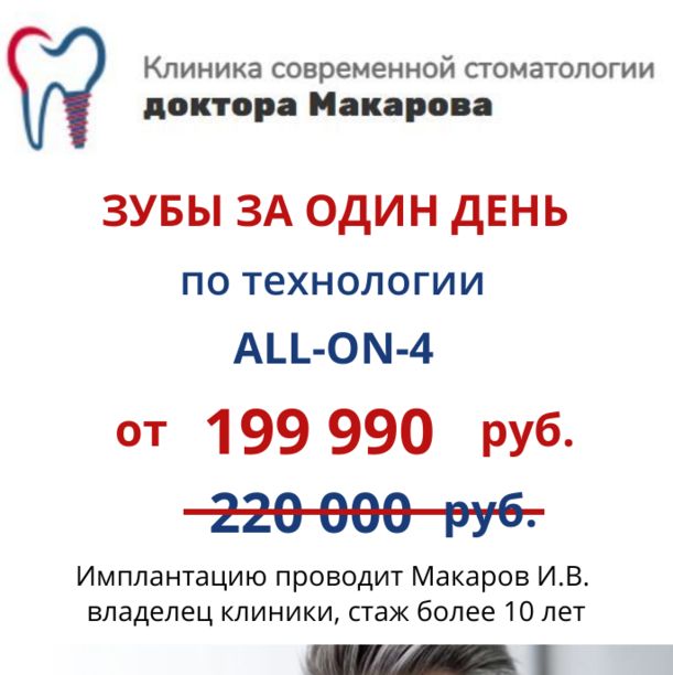 Зубы за один день - технология All-on-4