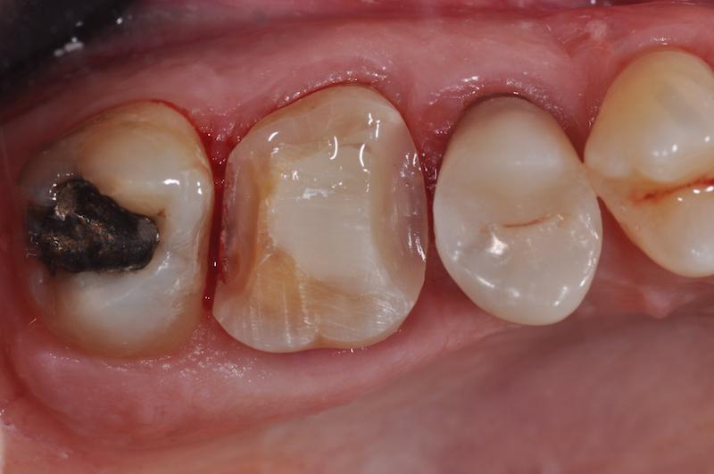 ef4465ef.JPG