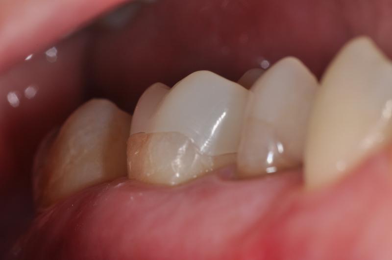 bc94c29a.JPG