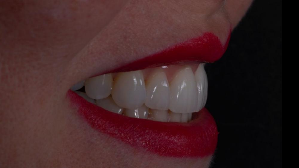 c827612c.jpg