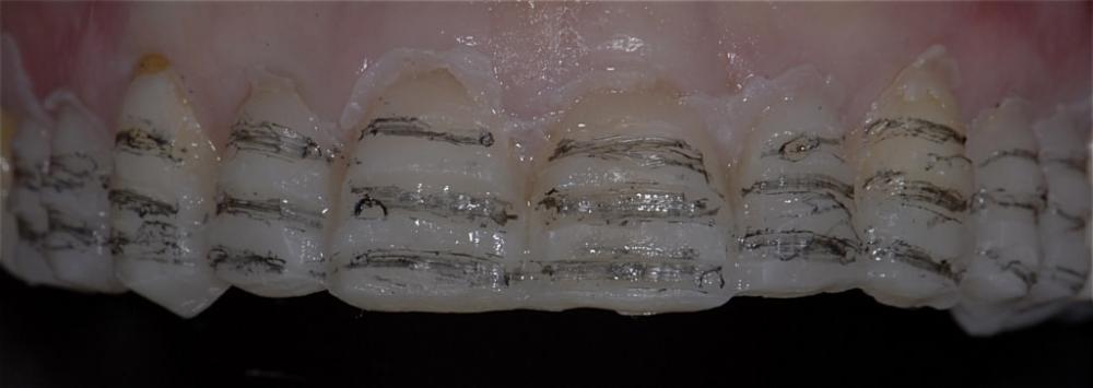 10-min.JPG