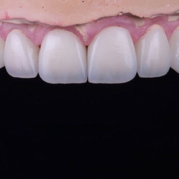 Зубное ателье - фотография