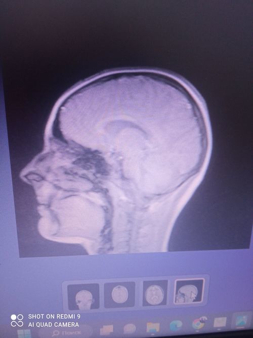 МРТ мозга ребенка - фото №1