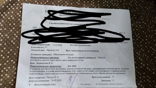 Стентирование желудка - фото №2