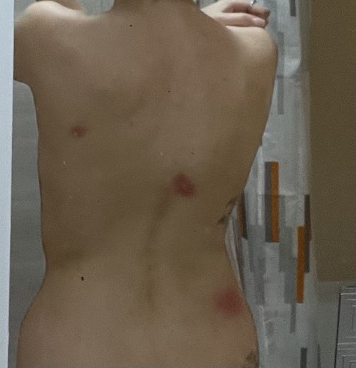 зуд и пятна - фото №1