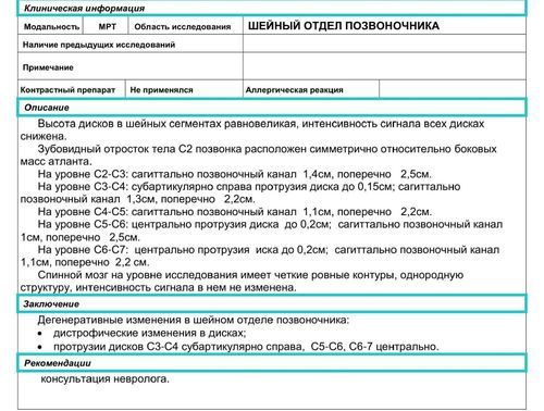 Очень болит спина - фото №1