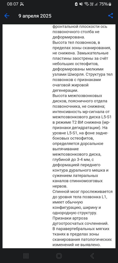 Боли в пояснице - фото №1