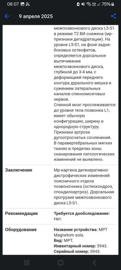Боли в пояснице - фото №2