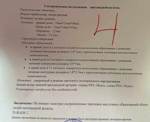 Кисты в щитовидке - фото №4