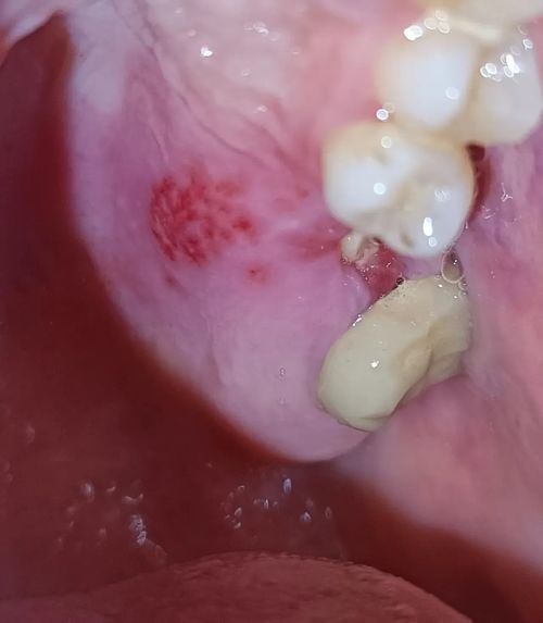 Красные пятна на небе - фото №1