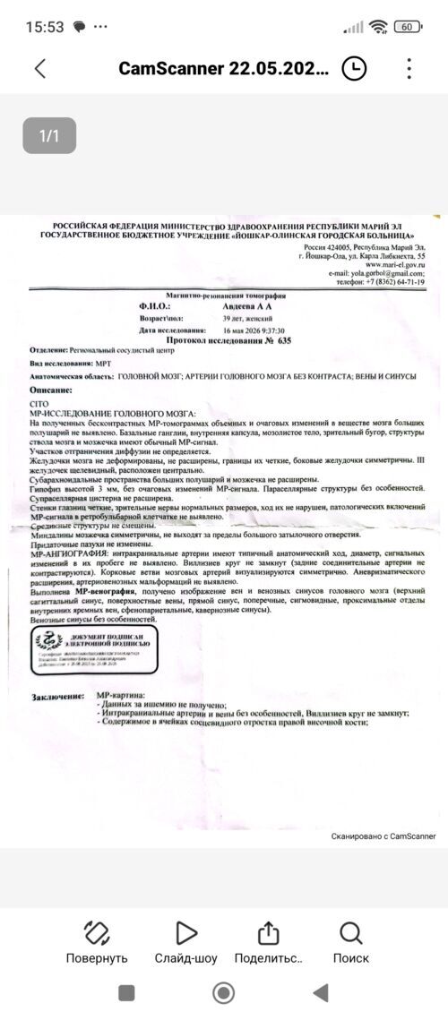 Неврит зрительного нерва - фото №1