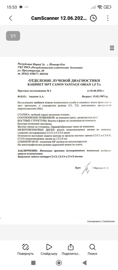 Неврит зрительного нерва - фото №4