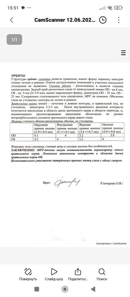 Неврит зрительного нерва - фото №14