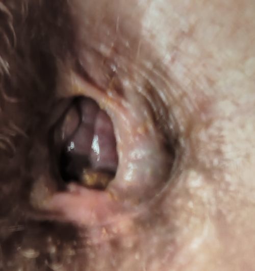 Шишки в попе - фото №2