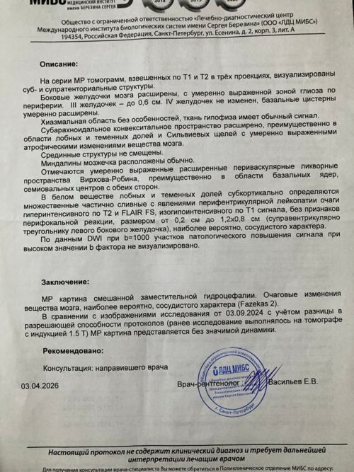 тремор левой руки и ноги, - фото №1
