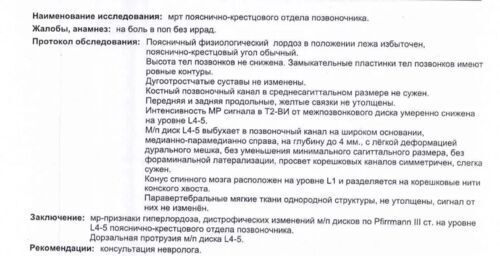 Защимление нерва - фото №3