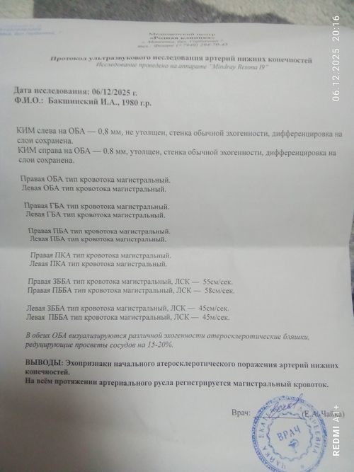 Тахикардия - фото №1