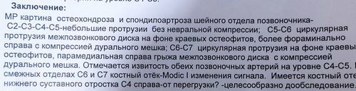 Сделала МРТ, хочу узнать что обозначает! - фото №1