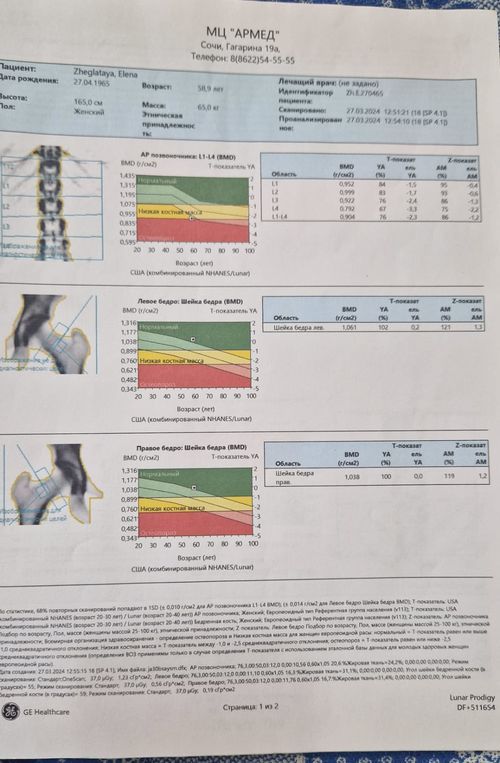 остеопения 3 степени - фото №2