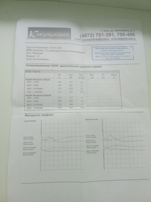 Остаточное онеменение под губой после инпланта+ небольшое опущение губы где отсутствуют жевательные зубы - фото №1