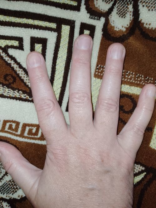 Похоже на ревматологию? - фото №1