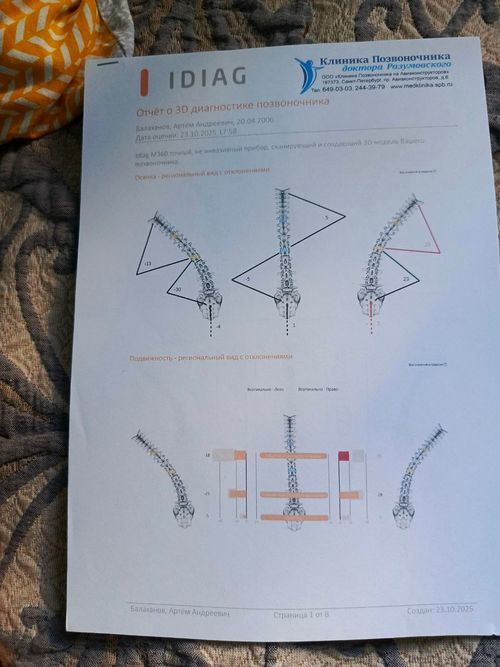 усиленный кифоз болезнь шейермана мау - фото №4