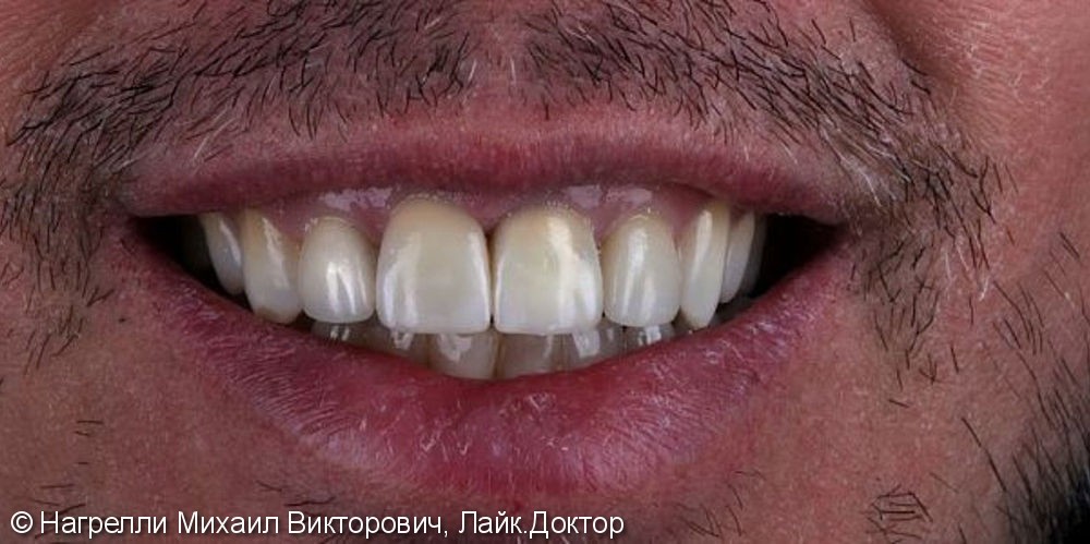 После