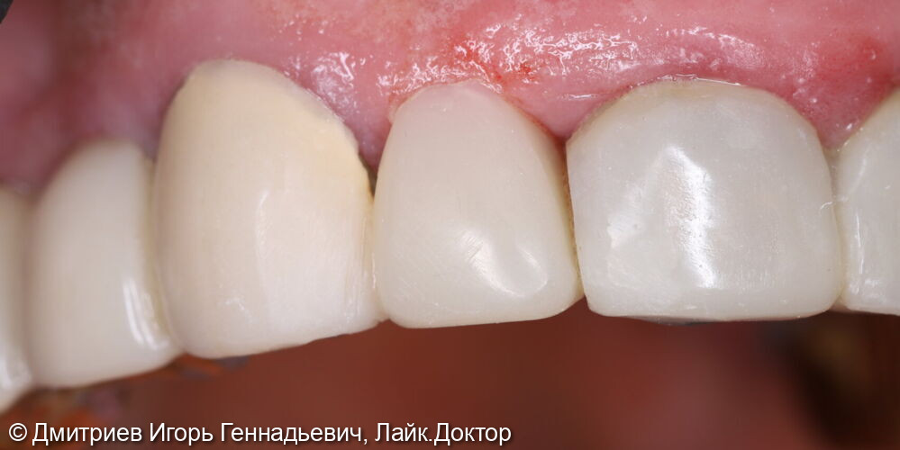 После