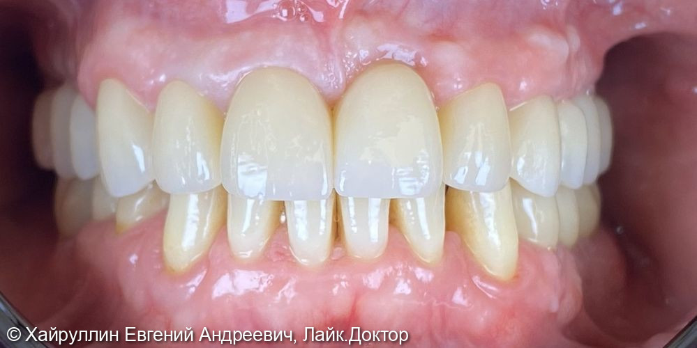 Протезирование фото 7 · Вологда
