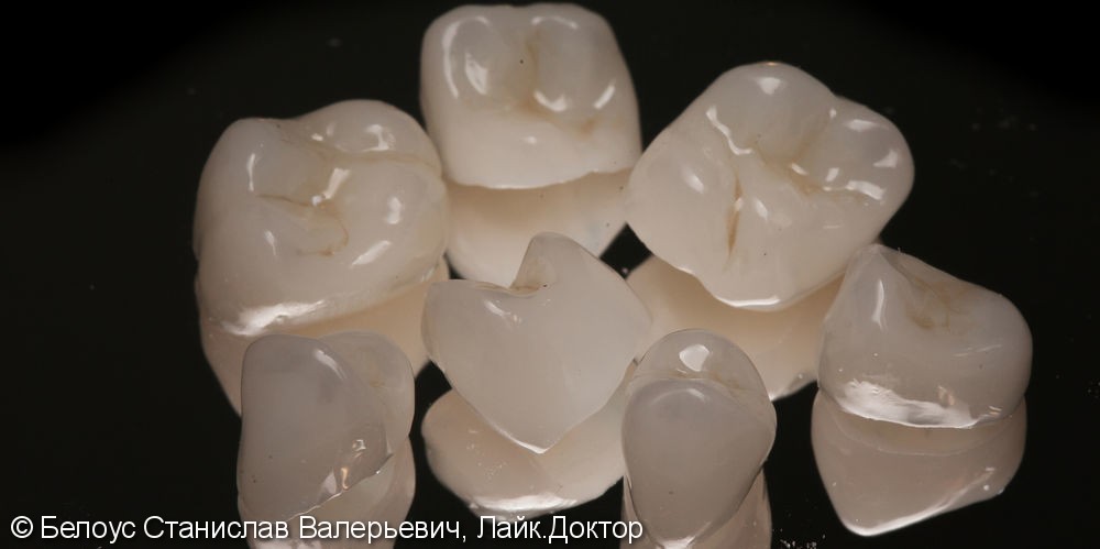 Лечение периодонтита и постановка коронок CEREC - фото №6