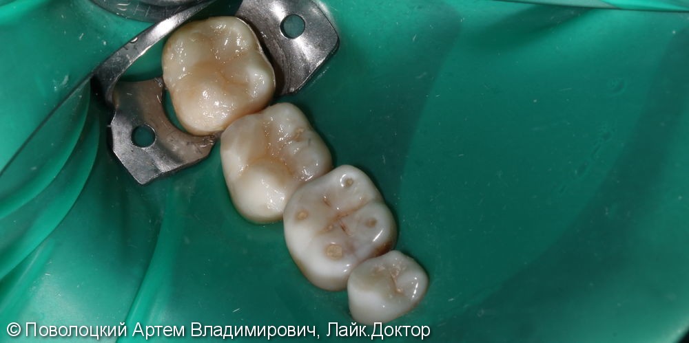 После