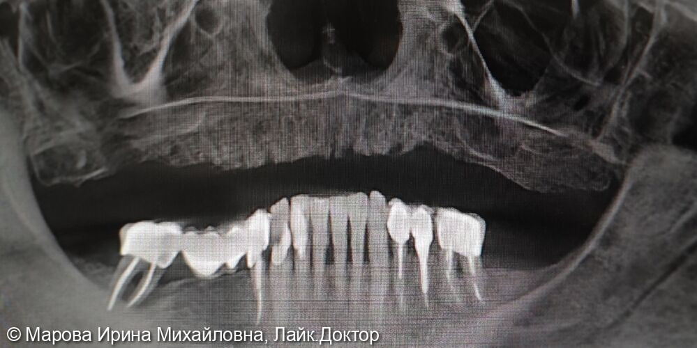 До