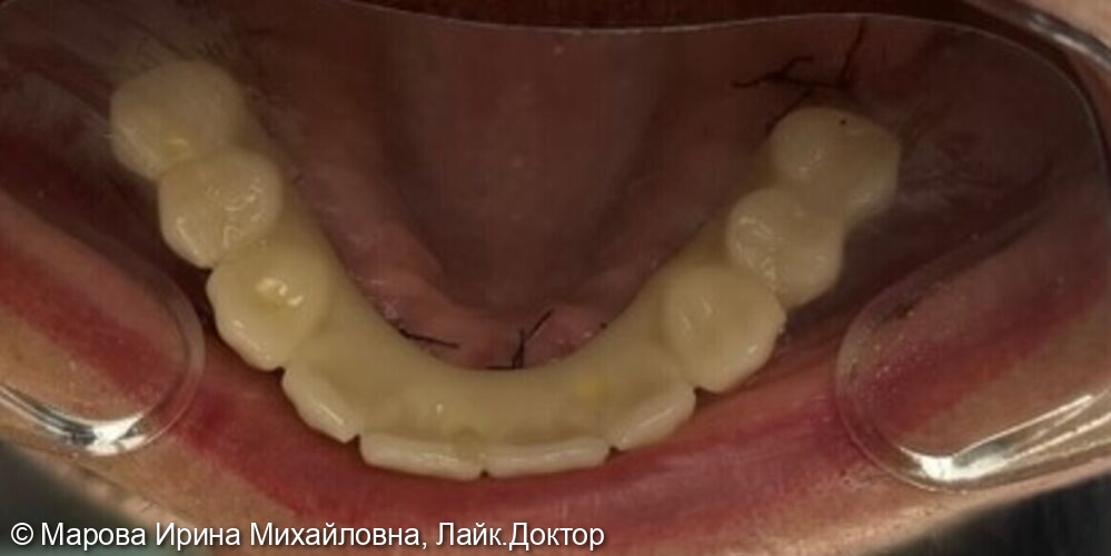 После