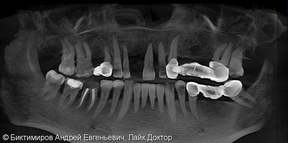 Сана́ция(лечение или оздоровление) по́лости рта в МКС Стоматология - фото №1