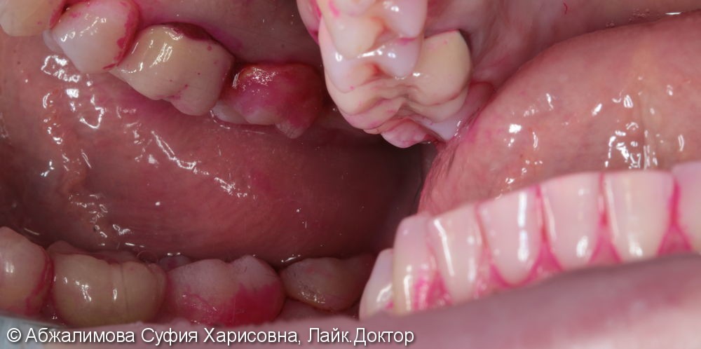 Профессиональная гигиена полости рта Curaprox 260, GC Tooth Mousse - фото №2