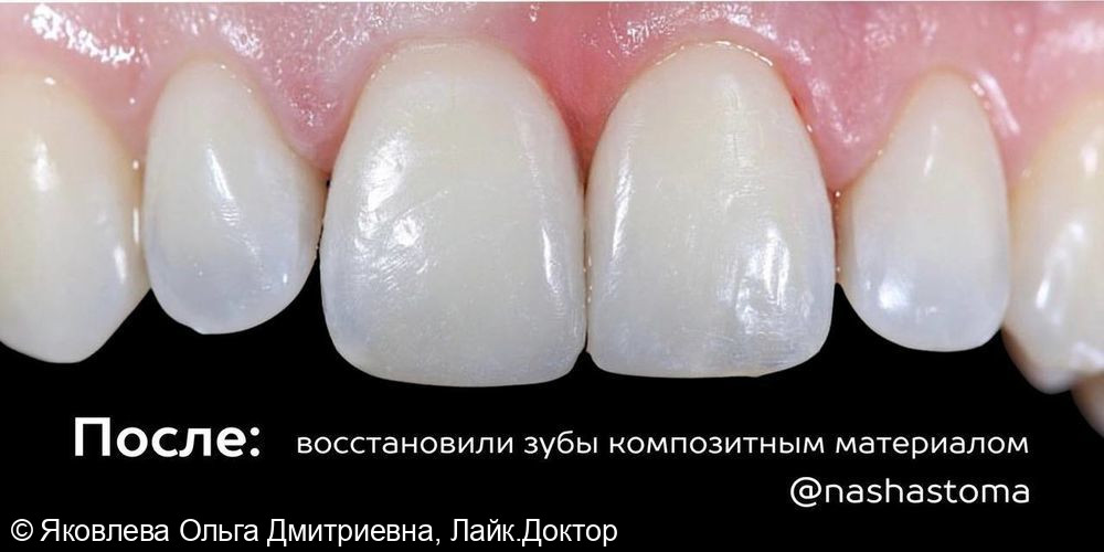 После