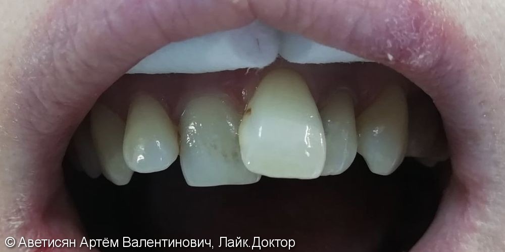 До