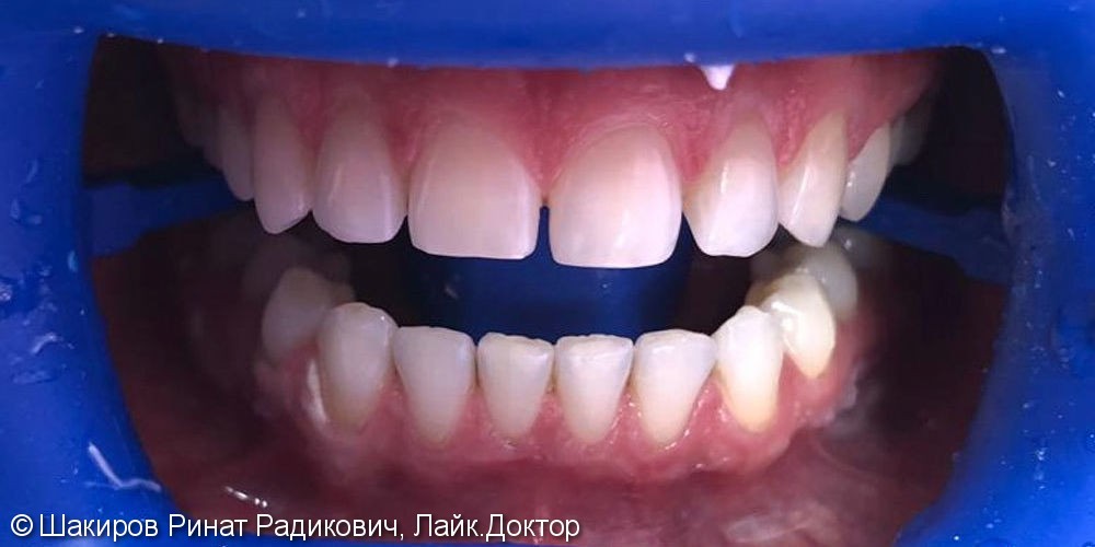 После