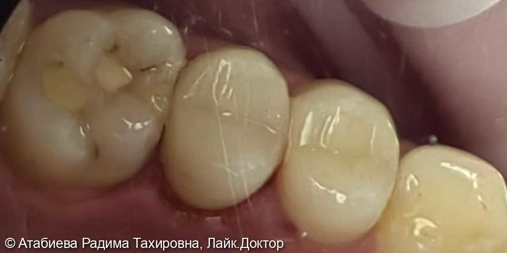 После