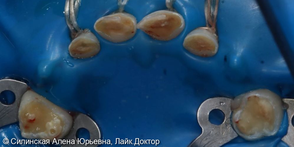 лечение в наркозе фото 3 · Вологда