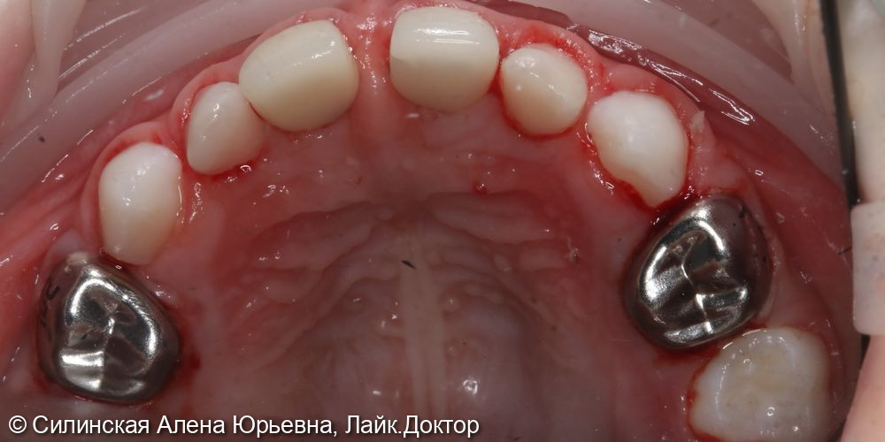 Лечение в наркозе фото 11 · Вологда