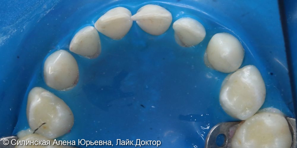 Лечение в наркозе фото 6 · Вологда