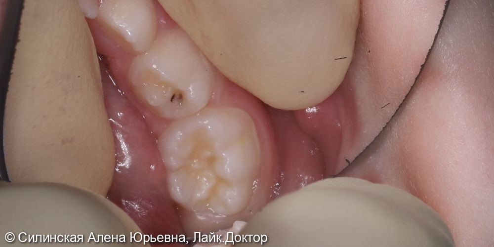 Лечение в наркозе фото 4 · Вологда