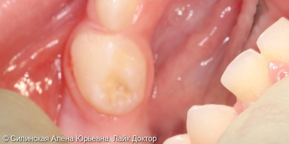 Лечение в наркозе фото 6 · Вологда