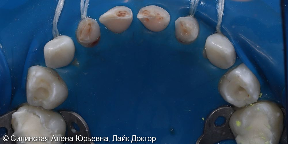 Лечение в наркозе фото 4 · Вологда