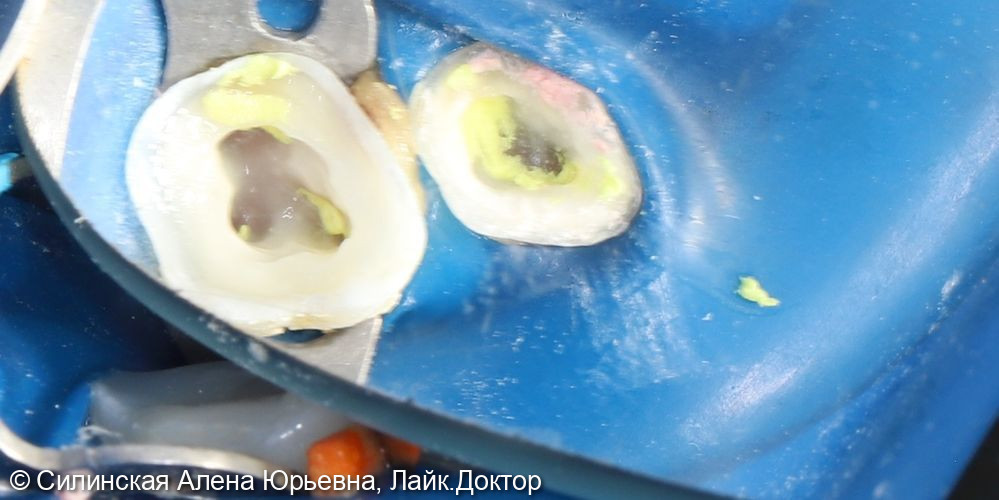 Лечение в наркозе фото 5 · Вологда
