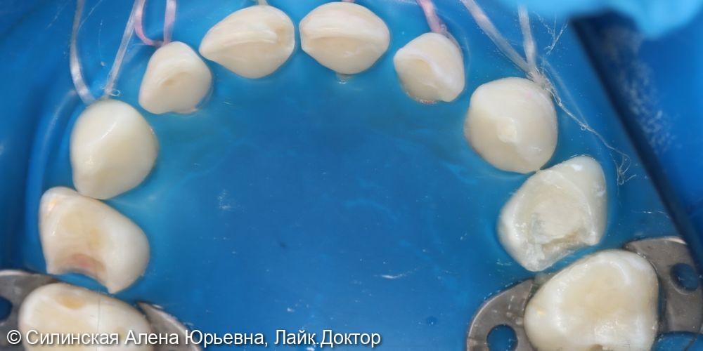 Лечение во сне фото 4 · Вологда